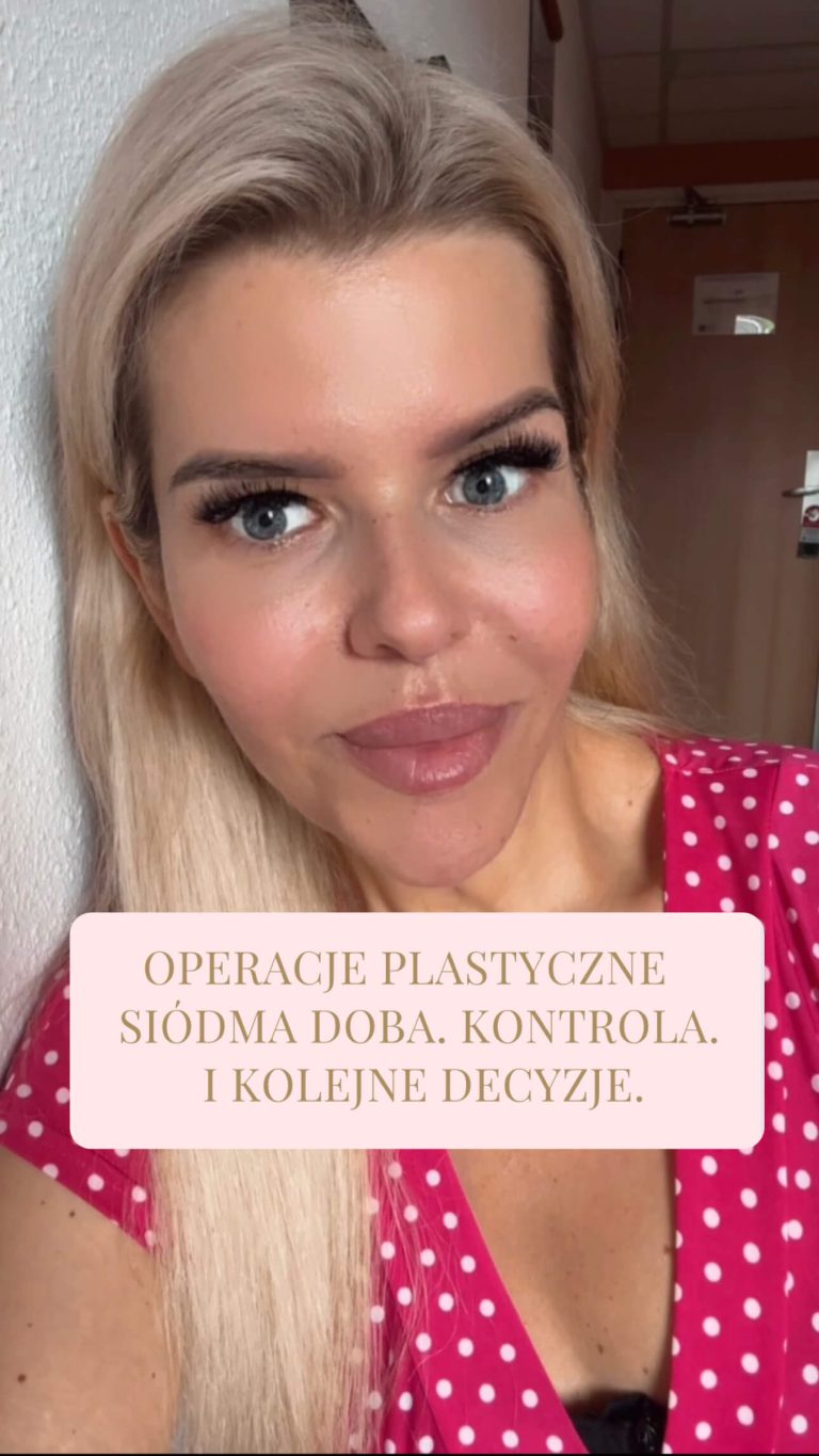 Operacje plastyczne. Siódma doba. Kontrola. Kolejne decyzje