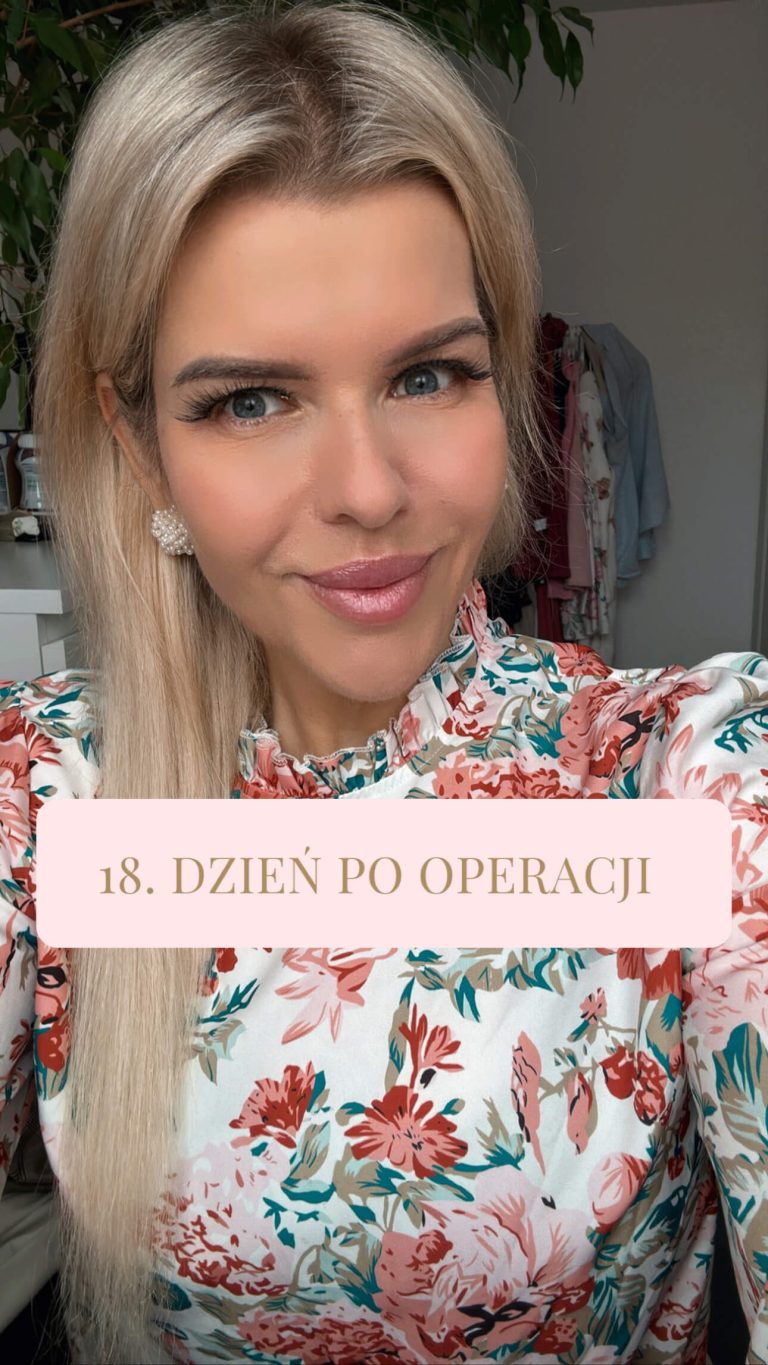 18. dzień po operacji