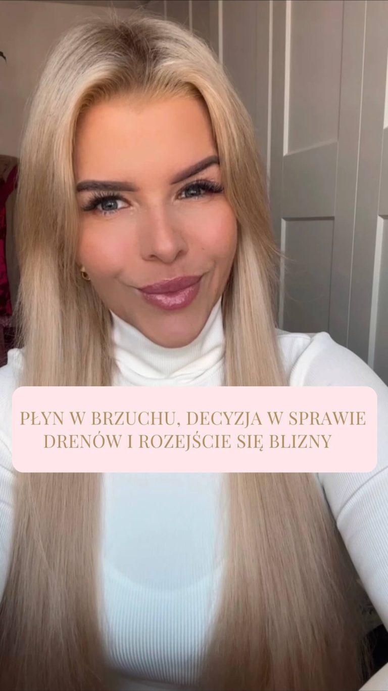 Płyn w brzuchu, decyzja w sprawie drenów i rozejście się blizny