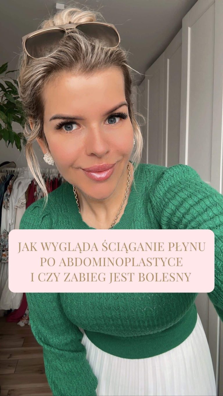 Jak wygląda ściąganie płynu po abdominoplastyce i czy zabieg jest bolesny