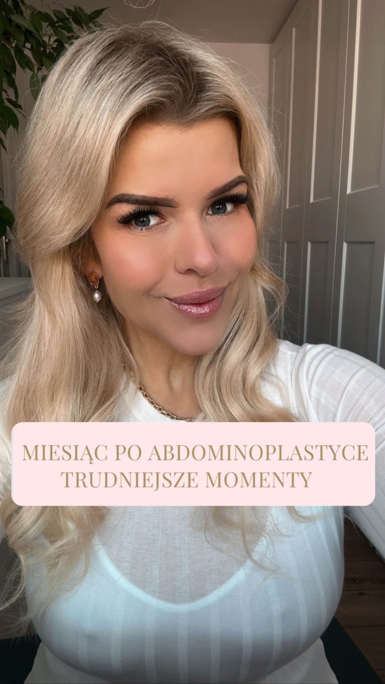 Miesiąc po abdominoplastyce. Trudniejsze momenty