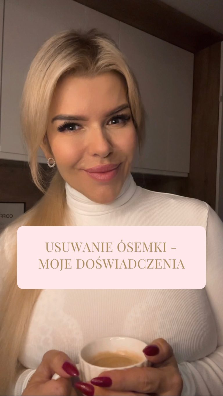 Usuwanie ósemki – moje doświadczenia