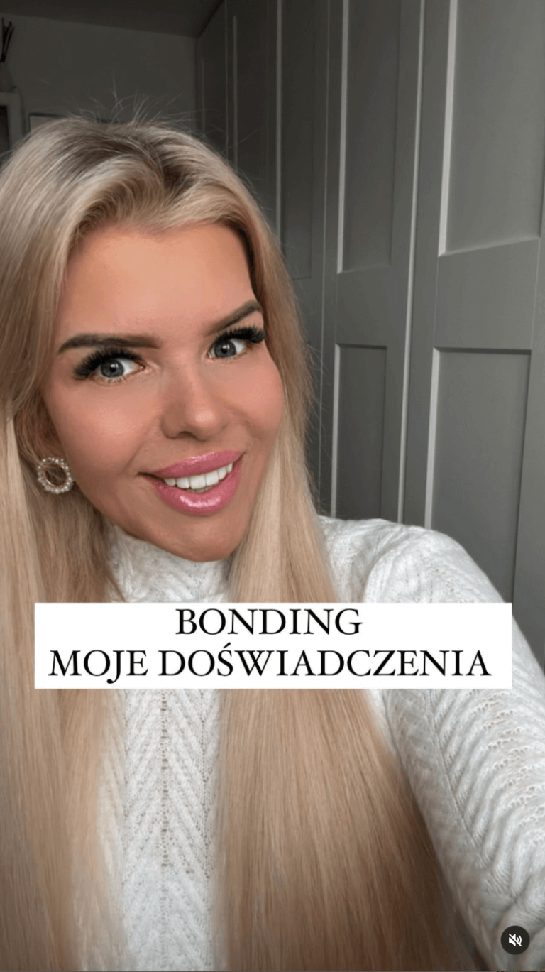 Bonding – moje doświadczenia