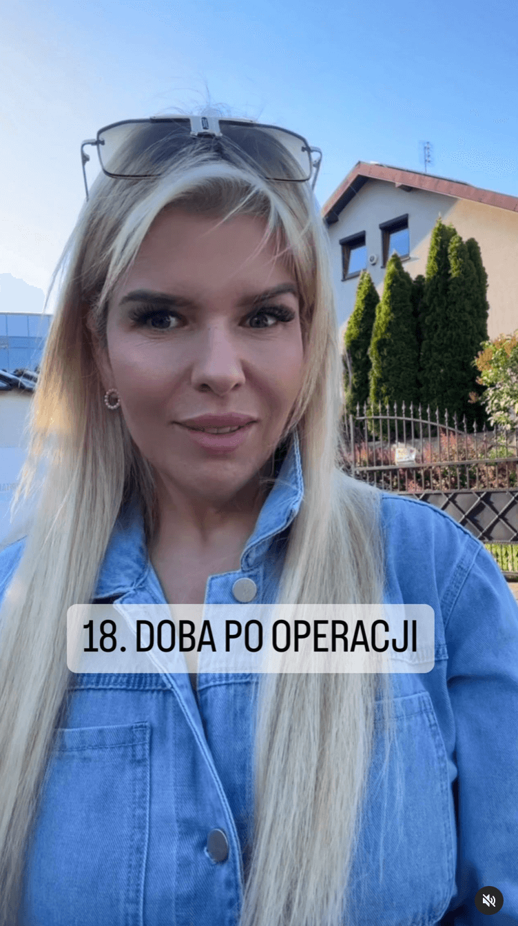 18. doba po operacji