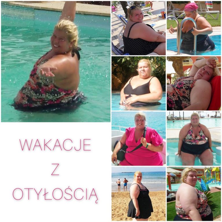 Wakacje z otyłością