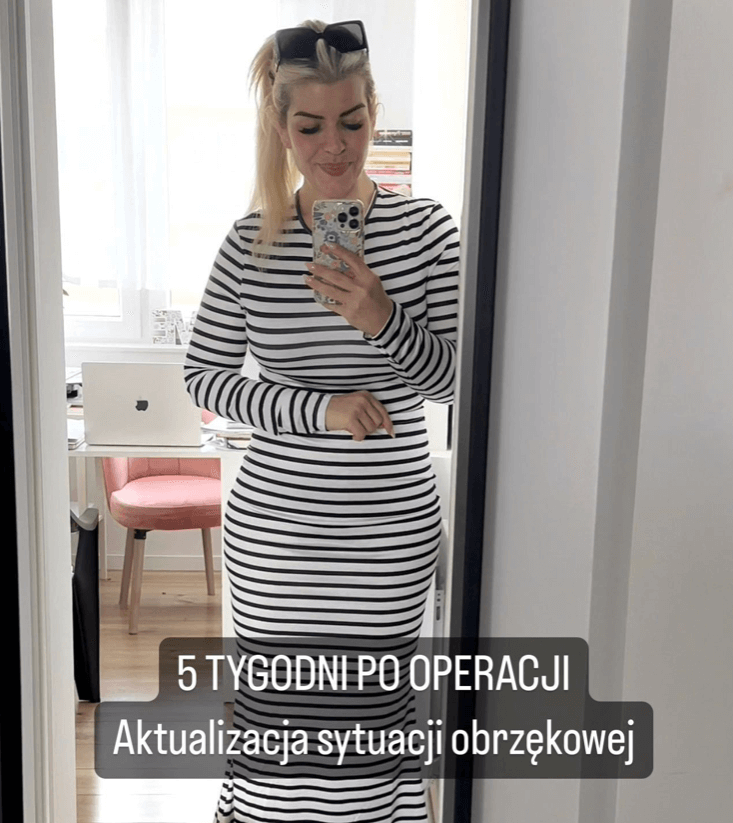 Aktualizacja sytuacji 5 tygodni po operacji ud