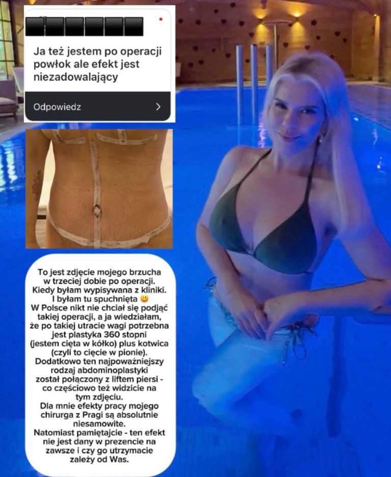 Trzecia część odpowiedzi na Wasze pytania